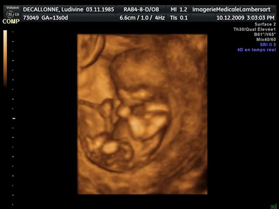 bébé 2