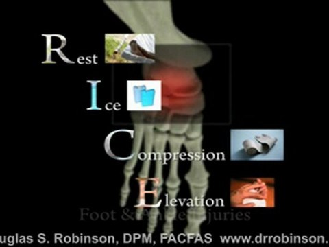 Foot and Ankle Injuries Campbell, CA