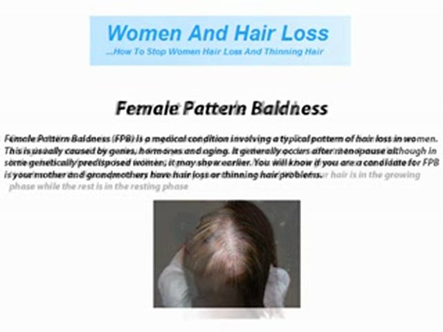 Female pattern baldness
