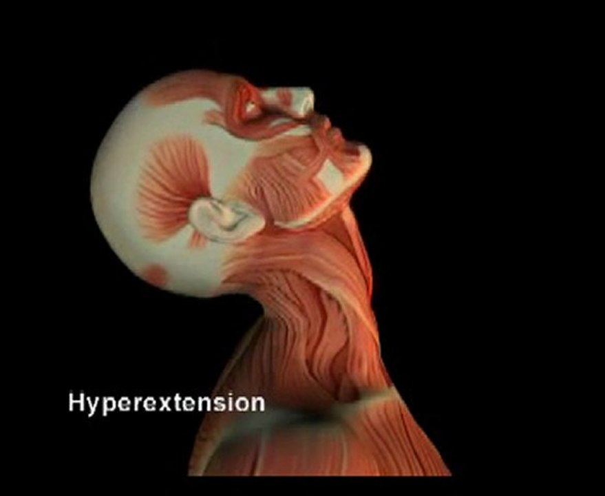 Recover From Car Accident Injuries - Chiropractor Atlanta Ga