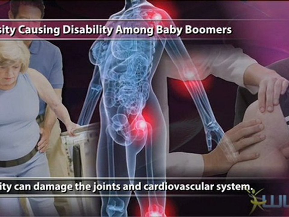 Obesity Causing Disability Among Baby Boomers