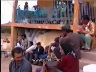 Acirli koyu - Sasik dayi anisina