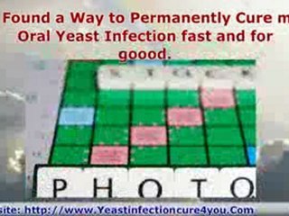 I Cured My Oral Yeast Infection in No Time at All - For Good