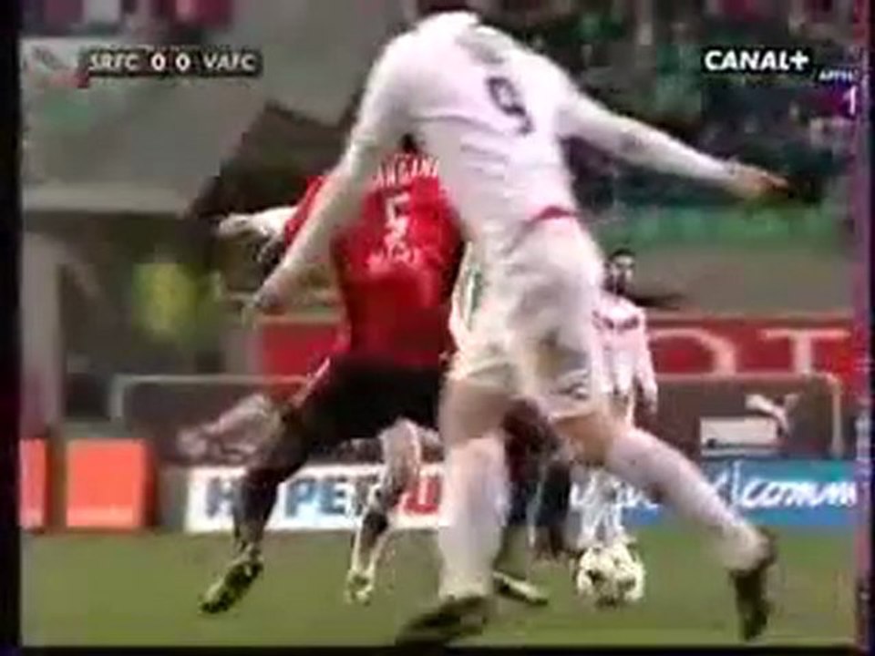 Lacourt Jonathan, Fracture du Tibia  Valenciennes contre R