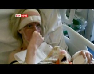 Une animatrice britannique brûlée à l'acide revient sur se