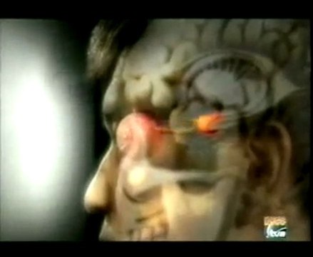 Estres postraumatico y cerebro (amigdala a hipocampo)