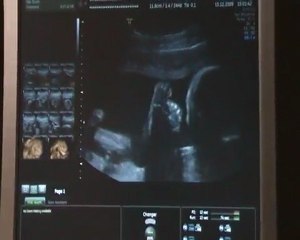 Notre bébé d'amour à 6 mois