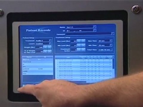 Spinal Decompression Beverly Hills, CA | Pinched Nerve