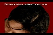 PERDITA DEI CAPELLI MASCHILE E FEMMINILE www.luigiuomo.com