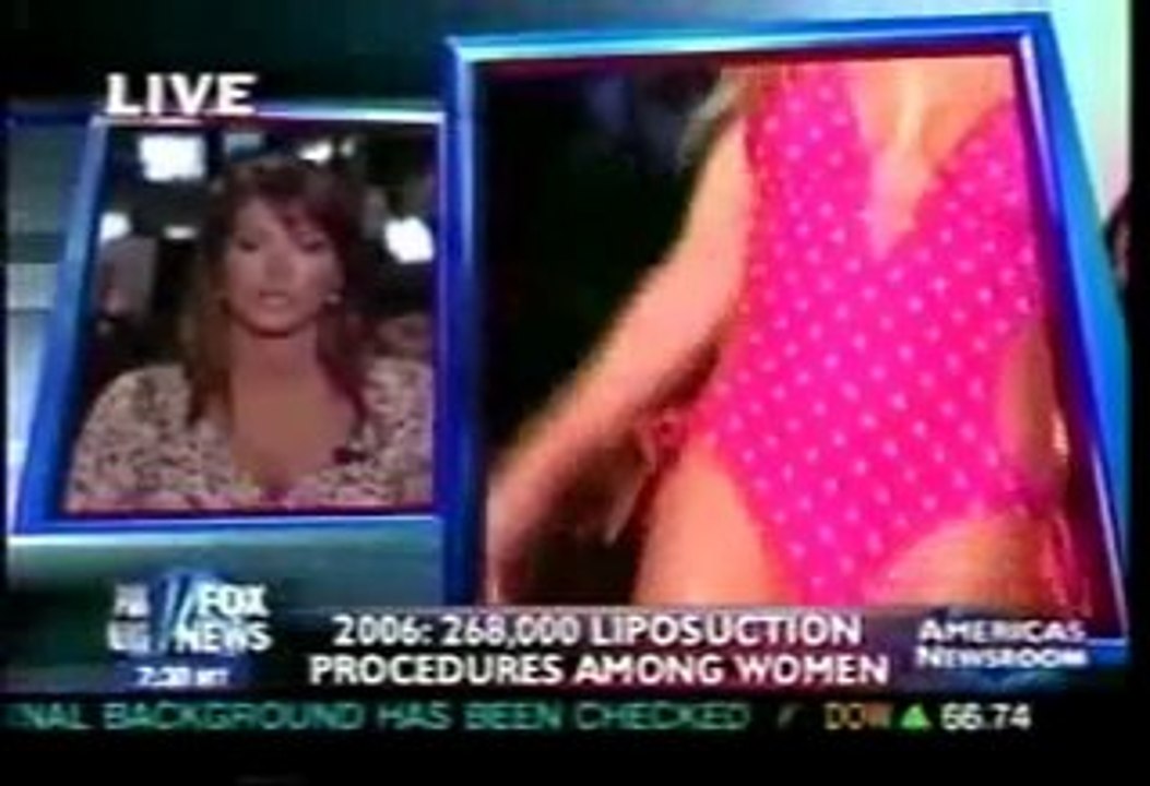 SmartLipo - Lee Canfield