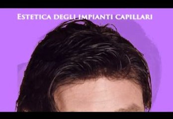 CADUTA DEI CAPELLI www.luigiuomo.com