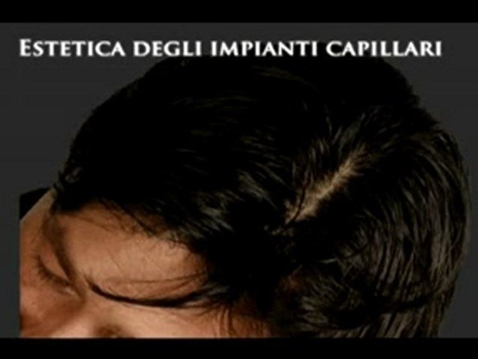 PERDITA DEI CAPELLI DONNA www.luigiuomo.com