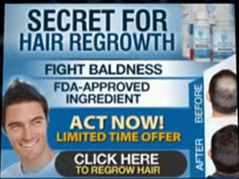 Provillus Stop Thinning Hair For Men