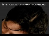 TRAPIANTO CAPELLI www.luigiuomo.com