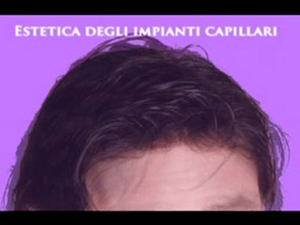CURE PER L'ALOPECIA www.luigiuomo.com