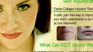 ECIT For Hyper & Hypo Pigmentation, Acne Scars, Stretch Mark