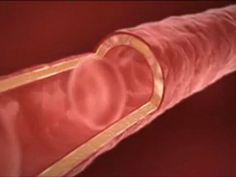 Aloe Vera Nettle - aloe-vera-infos.over-blog.com