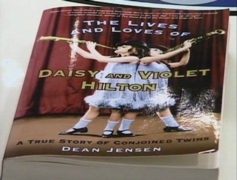 NANAR STORY La monstrueuse romance des soeurs Hilton