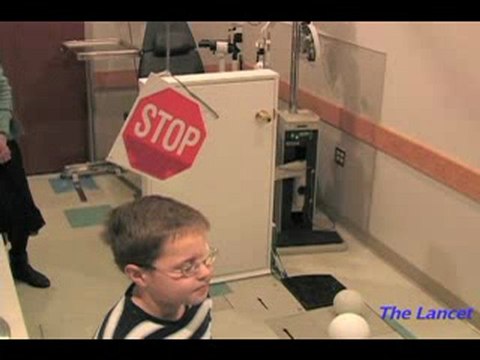 Thérapie génique contre une maladie héréditaire des yeux (