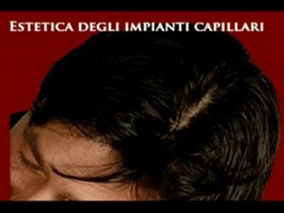 DIRADAMENTO CAPELLI CAUSE www.luigiuomo.com
