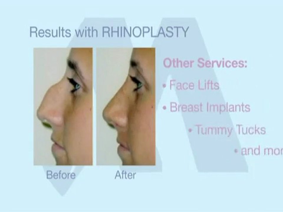 Haitham Masri for Laser and Cosmetic Surgery - Plastic Surge