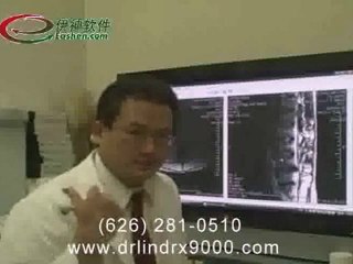 DRX 9000 Case Dtudy - Neck part 2