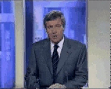 Bruit et santé : cochlee endommagée