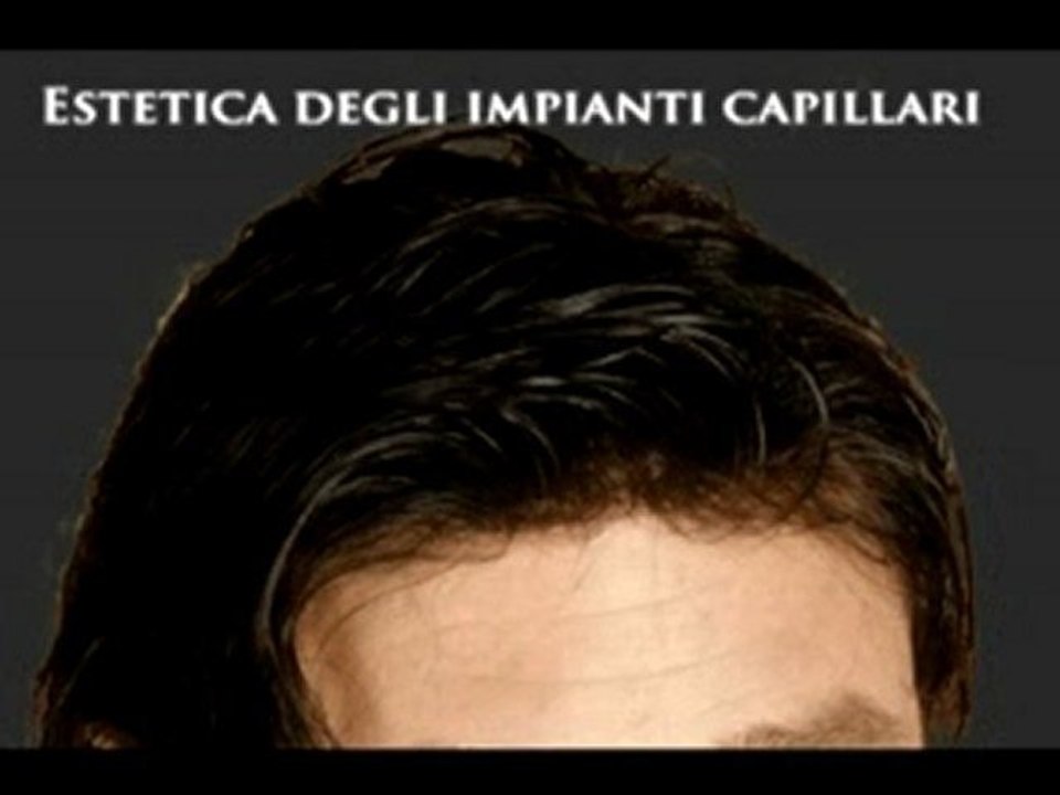 CENTRO IMPIANTI CAPELLI www.luigiuomo.com