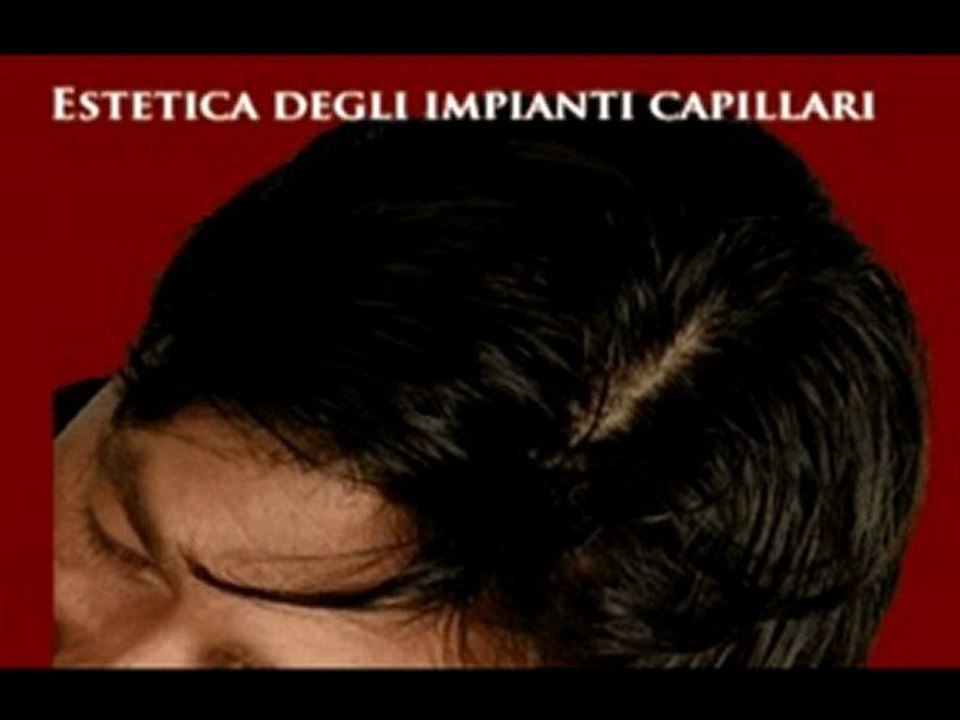 CENTRO PROTESI CAPELLI www.luigiuomo.com