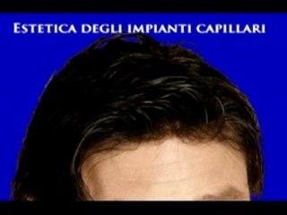 MALATTIE DEI CAPELLI www.luigiuomo.com