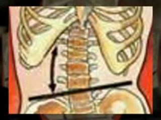 Austin Spinal Decompression