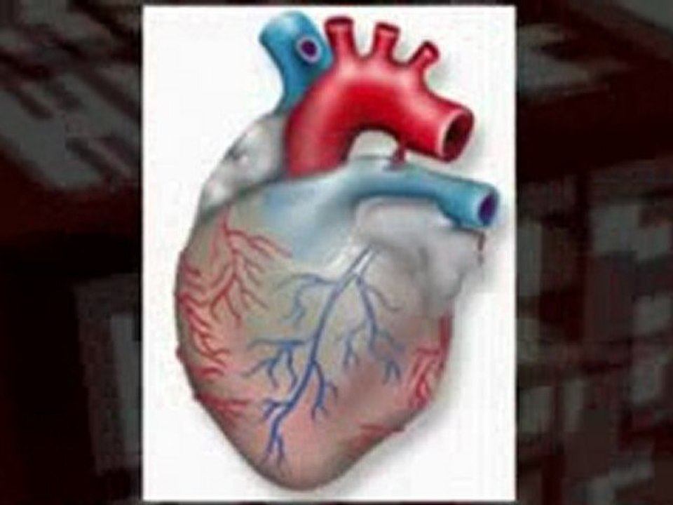 Symptome Schlaganfall - Hilfe bei Schlaganfall