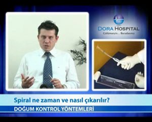 Spiral Ne Zaman ve Nasıl Çıkarılır?