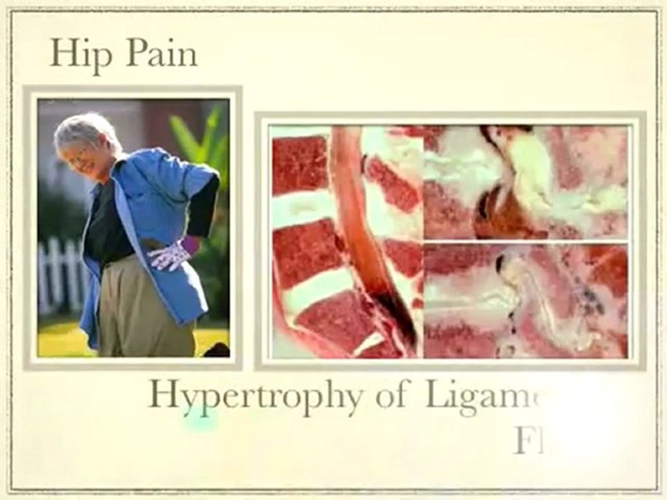 Back Pain Treatment - #1 Chiropractic center w/ US chiropra