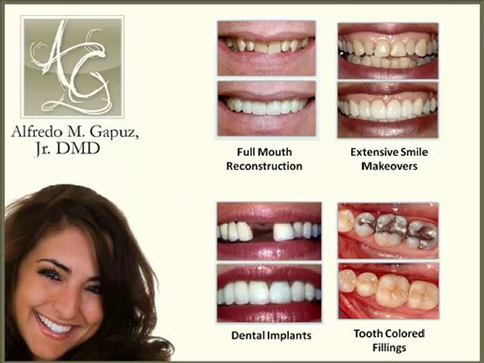 Cosmetic Dentistry by Lake Mary Florida Dentist Dr. ...