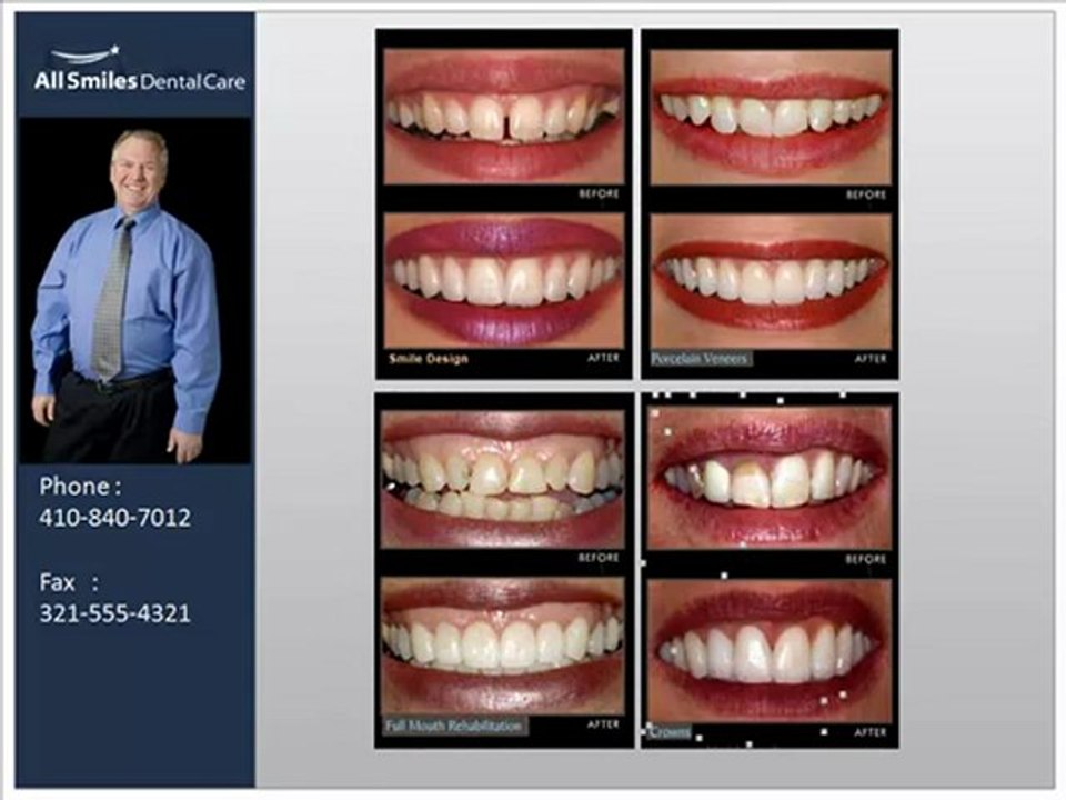 Cosmetic Dentistry by Westminster Maryland Dentist Dr. ...