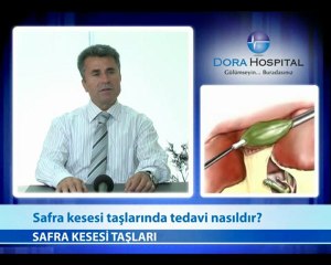 Safra Kesesi Taşlarında Tedavi Nasıldır?
