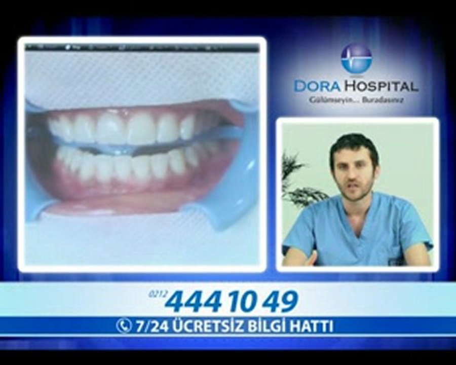 Diş Beyazlatma Kalıcı Bir Tedavi midir?