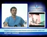 İmplant Operasyonundan Hemen Sonra Protezler Takılır mı?