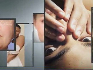 Botox, Restylane and skincare  in Palo Alto - Watch Our Vid