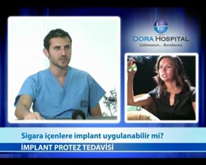 Sigara İçenlere İmplant Uygulanabilir mi?