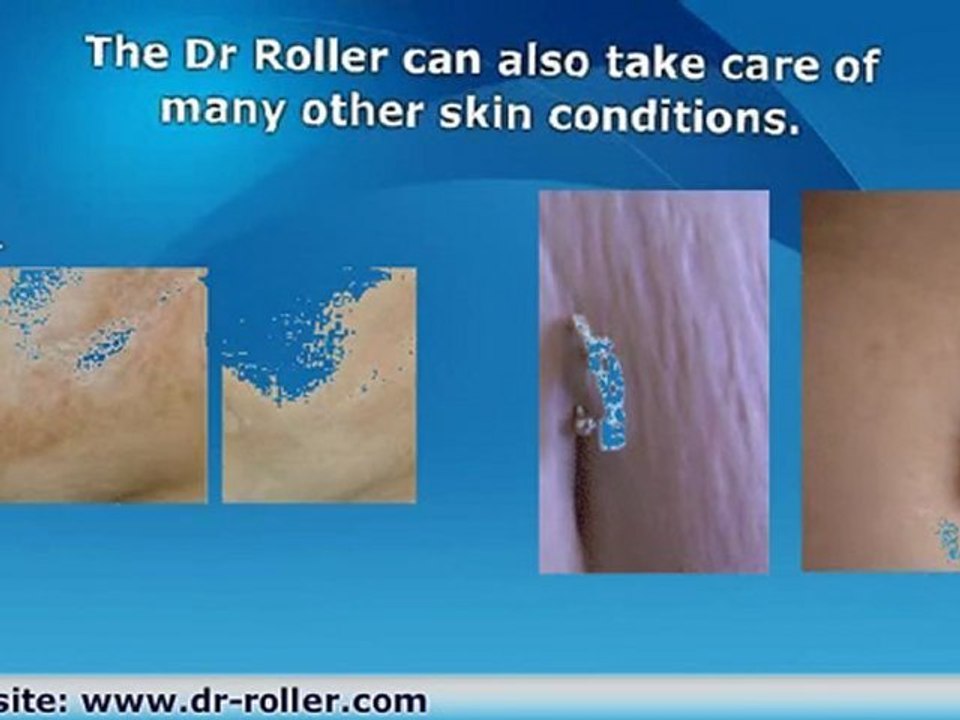 Dr. Roller