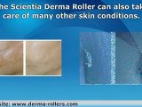 Micro Needle Skin Roller