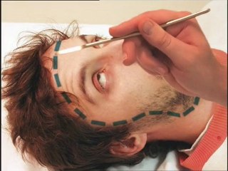 le bidule - la chirurgie esthetique