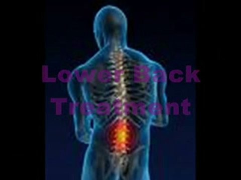 Chiropractor Newport Beach TMJ Precision Chiropractic