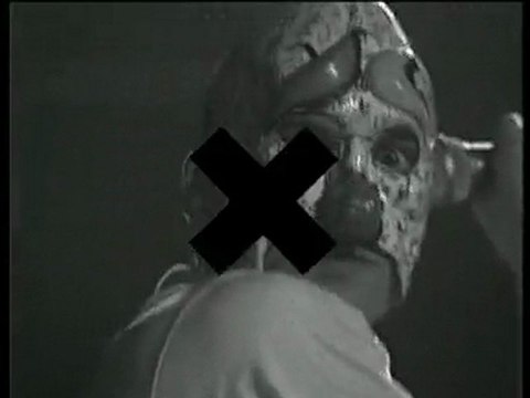 Bérurier Noir - Lobotomie