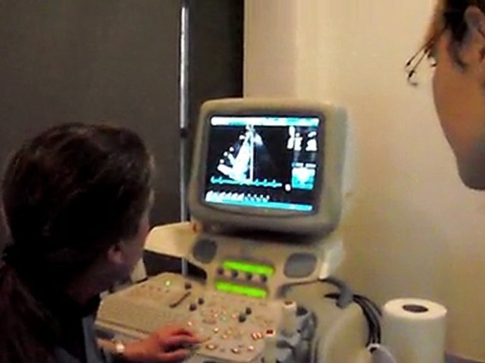 Heart echo doppler