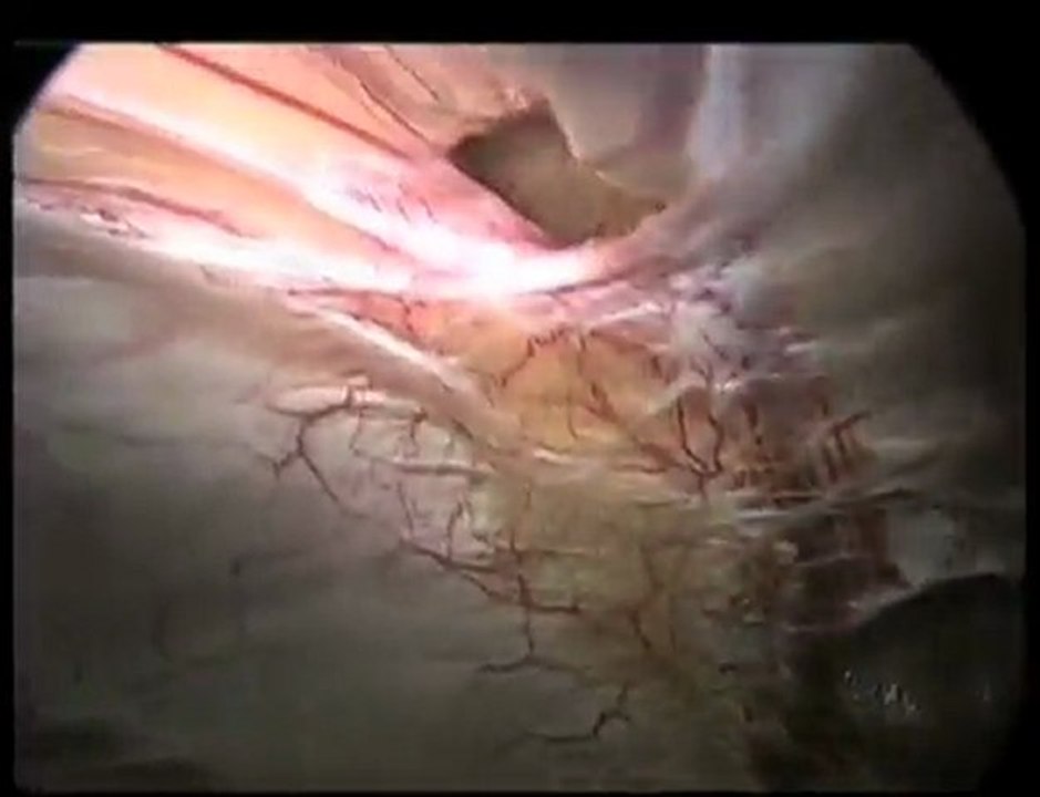 Discover the Surgical Weight Loss San Antonio Promotes