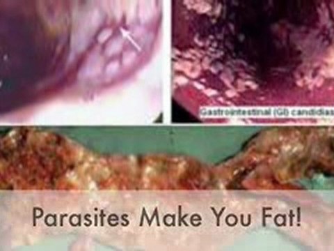 Cleanse Parasite For Health And Weight Loss