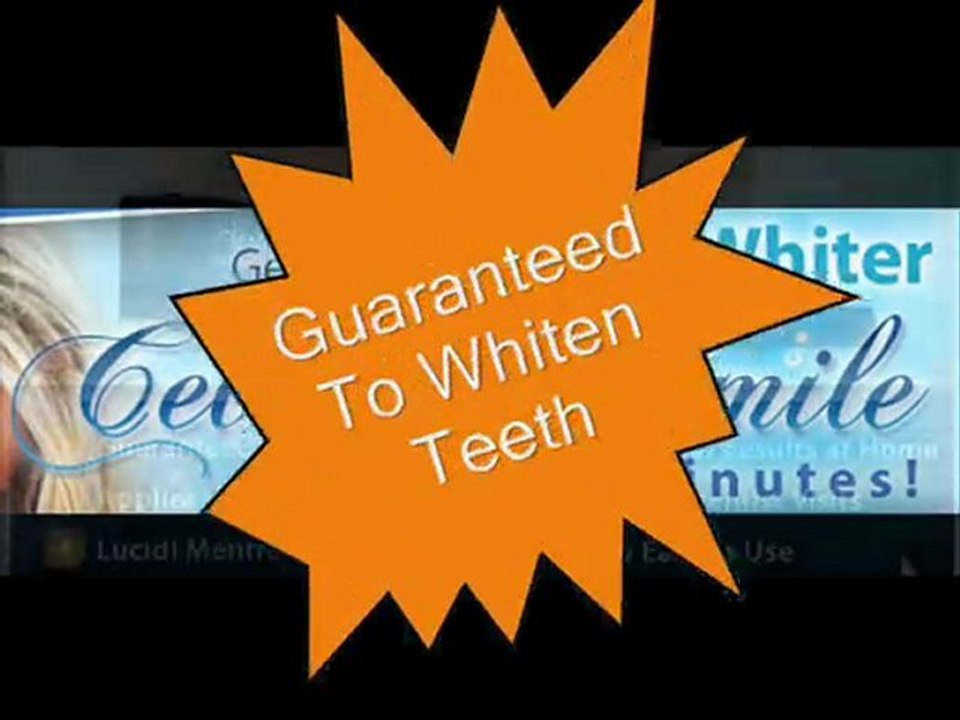 American Idol White   Teeth Whitening Gel